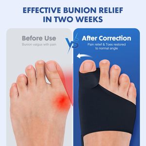 Correcteur d'alignement des orteils avec attelle et coussinets pour soulager la douleur du <span class=keywords><strong>hallux</strong></span> <span class=keywords><strong>valgus</strong></span>, séparateur d'orteils confortable pour le soutien jour/nuit - Product Image 3