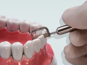 Nha khoa IPR Hệ thống chỉnh hình răng interproximal men giảm qua lại với 4:1 Contra góc tay khoan kit công cụ chỉnh hình răng - Product Image 3