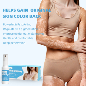 สเปรย์รักษาโรคด่างขาว 30 มล. ขายส่ง สเปรย์ดูแลผิว ลดจุดด่างขาว - Product Image 3