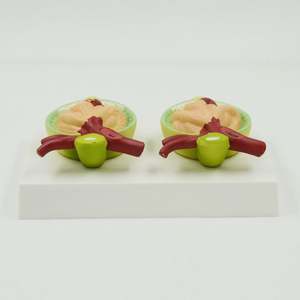 KyrenMed Modèle de protéinurie humaine élargie Grossissement Modèle de rein Corpuscule rénal Anatomie de l'<span class=keywords><strong>hypertension</strong></span> urologique Glomérulaire - Product Image 2