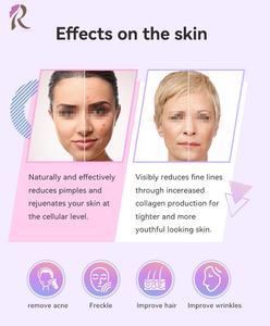 Varita Portátil de Alta Frecuencia de 9 Niveles para Tratamiento del Cuero Cabelludo, Máquina de Terapia de la Piel con Electrodos de Argón y Neón para Tratamiento Facial y Corporal - Product Image 2