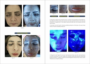 AI Automatic HD 7-inch Touchscreen Wrinkle Removing Facial & Body Skin Analyzer with 3D Analysis Technology - Product Image 2