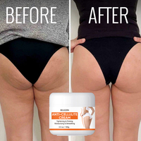 Crème hydratante pour le corps anti-cellulite pour les fesses et les cuisses, cible les fossettes tenaces