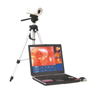Colposcope numérique pour gynécologie, caméra électronique de colposcopie vidéo pour <span class=keywords><strong>vagin</strong></span> - Product Image 3