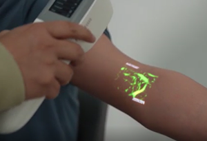 El kızılötesi damar bulucu makine hastane tıbbi parmak vasküler Illumintor dedektörü damar bulucu - Product Image 6