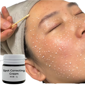 Crema para Eliminar Pecas <span class=keywords><strong>de</strong></span> 50 ml, Cuidado <span class=keywords><strong>de</strong></span> <span class=keywords><strong>la</strong></span> Piel, Eliminador <span class=keywords><strong>de</strong></span> Pigmentación para el Acné y <span class=keywords><strong>Manchas</strong></span> Oscuras <span class=keywords><strong>en</strong></span> el Rostro - Product Image 1