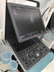 CE ISO disetujui sonobape <span class=keywords><strong>S8exp</strong></span> warna Doppler portabel mesin Ultrasound plastik elektrik dengan layar LED 15 inci untuk rumah sakit - Product Image 5
