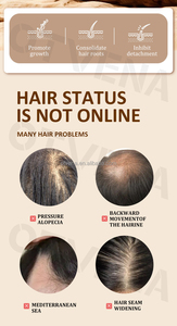 OTVENA <span class=keywords><strong>Olio</strong></span> di Cocco 100% Biologico per Riparazione Profonda e Lisciatura dei Capelli Secchi e Ricci, Prevenzione Caduta Capelli, 4 Settimane, 20ml - Product Image 6