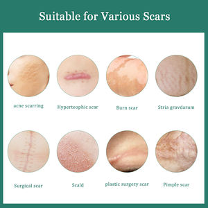 Crème chirurgicale pour enlever les cicatrices brûler le vieux visage traitement des cicatrices d'acné crème cicatrice lissante pour chirurgie - Product Image 3