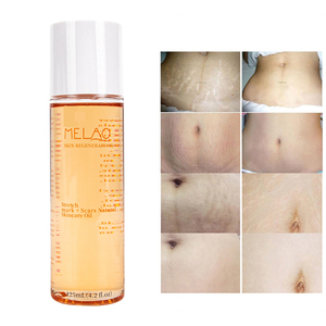 <span class=keywords><strong>Aceite</strong></span> Corporal Esencial <span class=keywords><strong>Regenerador</strong></span> para el Cuidado de la Piel Natural y Orgánico de Marca Privada, Reparación de <span class=keywords><strong>Cicatrices</strong></span>, Prevención, Eliminación de Estrías - Product Image 3