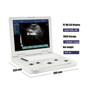 Escáner <span class=keywords><strong>de</strong></span> <span class=keywords><strong>Ultrasonido</strong></span> Portátil, Completamente Digital, en Blanco y Negro, para Diagnóstico Clínico <span class=keywords><strong>Abdominal</strong></span>, Obstetricia y Ginecología Humana - Product Image 3