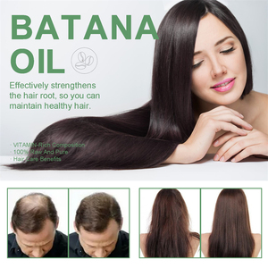 Crema de Aceite de Batana Wiyun 100g, Fortalece las Raíces del Cabello, Anticaída, Reparadora, Hidratante y Suavizante - Product Image 2