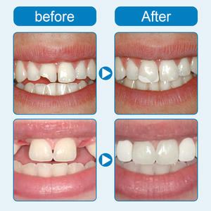 คุณภาพสูงสร้างฟันชุดชั่วคราวปาร์ตี้แวมไพร์ฟิกซ์ฟันฟันปลอมกาว - Product Image 5