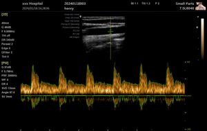 गर्भावस्था का उपयोग 3 डी यूग मेडिकल अल्ट्रासाउंड मशीन इकोग्राफो डिजिटल कार्डियक रंग डॉपलर pw पशु चिकित्सा अल्ट्रासाउंड स्कैनर - Product Image 3
