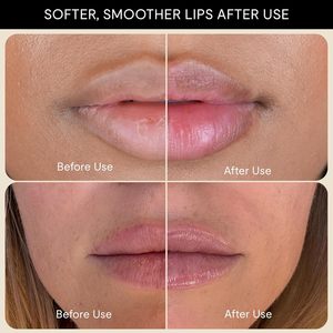 Bálsamo Labial ETRUN <span class=keywords><strong>ALISA</strong></span> OEM, Mascarilla Hidratante Nocturna para Labios Secos, Reparador con Manteca de Karité, Escualano y Vitaminas - Product Image 4