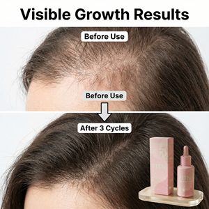 Suero Anticaída del Cabello de Venta Directa del Fabricante, 30 ml, Suero para el Crecimiento del Cabello, Aceite Natural de Marca Propia - Product Image 3