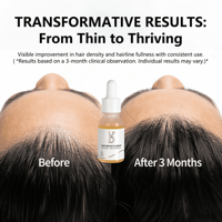 Sérum d'activation des follicules pour la croissance des cheveux et le contrôle de la perte de cheveux