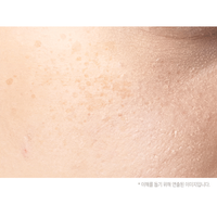 Crème Visage Anti-Mélanine Blanchissante à la Niacinamide pour les Taches de Rousseur 30g