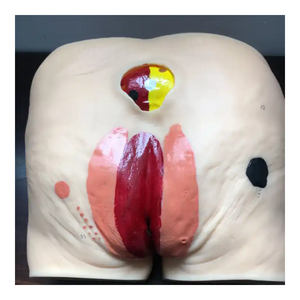 Modèle de soins infirmiers Ulcère de pression pour personnes âgées Modèle d'<span class=keywords><strong>escarre</strong></span> de science médicale pour les patients - Product Image 2