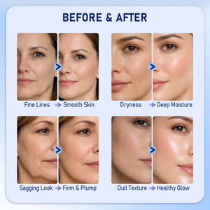 Prix Usine 0,5% 5000ppm Stick de Peptide de Cuivre Bleu pour les Rides du Contour des Yeux 20g Stick Éclat de Peau Effet Gelée <span class=keywords><strong>Baume</strong></span> Multi-Action Stimulant le Collagène - Product Image 6