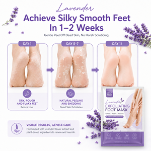 Hot Selling Gently Exfoliates Care Softens Rough Cracked Heels Hydrates Nourishes Lavender Niacinamide Exfoliating Foot Mask - Product Image 5