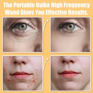 Máquina de Electrodos de Alta Frecuencia para Reafirmar la Piel, Eliminar Acné, Manchas y Arrugas, Terapia de Belleza, Cuidado Facial - Product Image 5