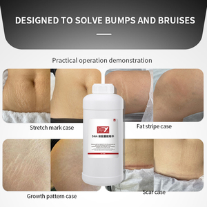 Crème PDRN puissante pour estomper les vergetures, lotion réparatrice post-partum pour la peau, atténue les cicatrices de grossesse - Product Image 2