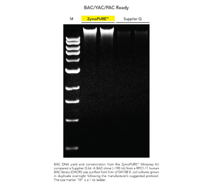 <span class=keywords><strong>Kit</strong></span> de préparation de minipréparations de plasmides ZymoPURE pour l'<span class=keywords><strong>ADN</strong></span> de haute pureté dans le clonage, la séquençage et la digestion par restriction - Product Image 4