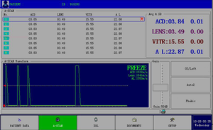Échographe ophtalmique AS-200 A-Scan avec sonde 10 MHz, imprimante intégrée, 6 formules IOL, technique d'immersion pour clinique ophtalmique - Product Image 3