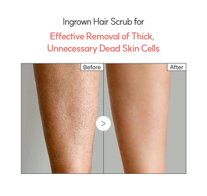 Exfoliante de Sal Reparador de Pétalos Azules, Elimina la Piel Muerta, Suaviza la Piel, Cuidado de los Poros, Cuidado Facial Suave para el Vello Encarnado - Product Image 5