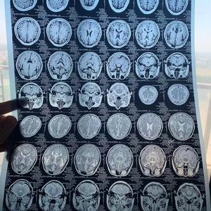 Film medico del Laser del DR CR di CT asciutta medica del Film X Ray del Laser blu 210 micron Film medico trasparente blu del Laser di Ziguang - Product Image 3