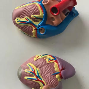 Modelo de Enseñanza de Ciencias Médicas, Patología Humana, <span class=keywords><strong>Diabetes</strong></span>, Anatomía <span class=keywords><strong>en</strong></span> PVC para Escuelas de Medicina - Product Image 6