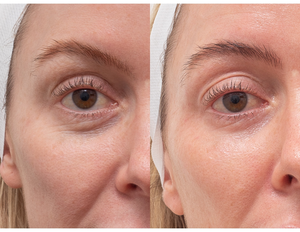 Precio de Fábrica, Láser de CO2 Fraccional de 10600nm para Blanqueamiento de Piel, Eliminación de Cicatrices, Tratamiento Ginecológico, Máquina de Láser de CO2 para Dermatología - Product Image 6