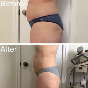 Traje de Entrenamiento Muscular EMS de Alta Intensidad con 4 Manijas, Equipo de Tonificación Corporal - Product Image 6