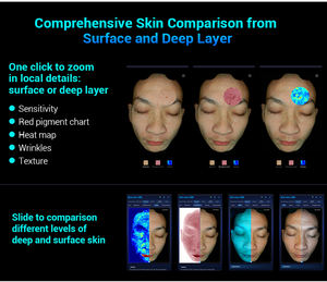 Taşınabilir 16 Dil Destekli Yüz Tarayıcı Yapay Zeka Cilt Analizörü Visia Cilt Analiz Cihazı Nem Kalemi ile - Product Image 4