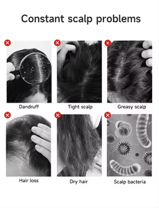 Mesin Perawatan Rambut Multifungsi 5 in 1 untuk Mengatasi Kerontokan Rambut, Merangsang Pertumbuhan Rambut, Perawatan Kulit Kepala, Analisis Kulit Kepala, Terapi Cahaya untuk Klinik, Spa, dan Salon - Product Image 3