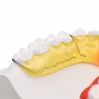 Oral Begg Wrap Around Retainer Diş Modeli Ortodontik Tedavi Sonrası Diş Aralıklarını Kapatır Diş Hekimliği Okulu Eğitim Öğretim Aracı