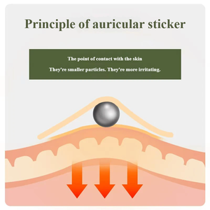 अनुकूलन योग्य ऑयरिकुलर एकुप्रेशर उत्तेजना पैच पारदर्शी हाइपोएलर्जेनिक उत्तेजना पैच टिनिटस राहत के लिए पैच - Product Image 3
