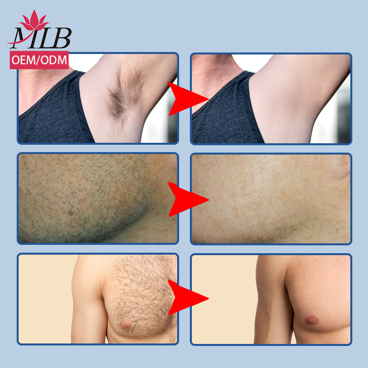 Частная этикетка, крем для безболезненной депиляции бороды для мужчин и мальчиков, крем для удаления волос и ремонт для мужчин