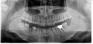 Conveniente Usato Carestream: Combinazione Panoramica CS 9000C 3D Panorex CEPH CONE BEAM per Imaging Panoramico e Cefalometrico - Product Image 6