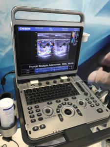 Chison Ebit50 draagbare echografiemachine Kleuren <span class=keywords><strong>Doppler</strong></span> voor OB&GYN, hartmeting met twee probes - Product Image 4
