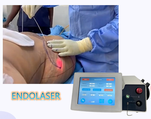 Endolaser 980nm 1470nm a Doppia Onda per Dermatologia, Rimozione Vene Vascolari, Chirurgia Plastica, Lifting Viso, Rassodamento Cutaneo - Product Image 1