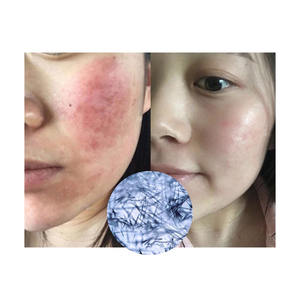 1000G Acne-Porne Gezichtscrème Bleekcrème Voor Donkere Huidvlekkenverwijderaar Private Label - Product Image 2