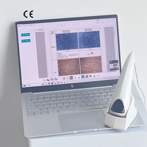 Analizador de Piel Digital Inteligente de Alta Definición, Instrumento de Belleza para Uso Doméstico, Detector para el Cuidado de la Piel, Venta al Por Mayor de Fábrica - Product Image 3