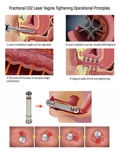 Nuevo Producto: Máquina de Belleza 2 en 1 con Láser Fraccional de CO2 + Láser de Diodo para el Cuidado de la Piel, 10600nm, para Tratamiento de Pecas - Product Image 5