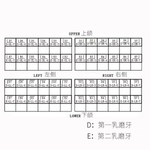 <span class=keywords><strong>Couronne</strong></span> dentaire en acier inoxydable pour enfants, <span class=keywords><strong>couronne</strong></span> <span class=keywords><strong>molaire</strong></span> primaire, <span class=keywords><strong>couronne</strong></span> temporaire - Product Image 4