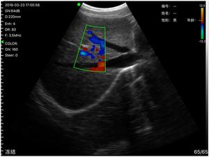 B26D二重妇人科超音波凸および产科医および产科医のための経膣 - Product Image 4