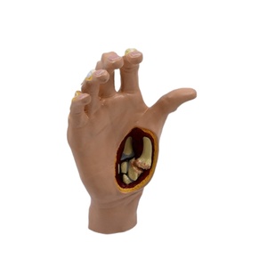 Démonstrato clinique de main de simulateur de pathologie pour l'enseignement orthopédique et rhumatologique - Product Image 3