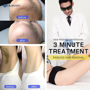 755nm 940nm 1064nm 808nm <span class=keywords><strong>Laser</strong></span> Dingin Diode Penghilang Bulu <span class=keywords><strong>Laser</strong></span> Depilatori Peralatan Klinik untuk Semua Warna Kulit - Product Image 6