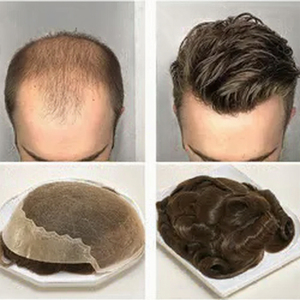 SuperThin Skin PU Base Grey #1B65 Q6 Virgin Remy Hair Patch Peluca <span class=keywords><strong>para</strong></span> hombres Cutícula Europea <span class=keywords><strong>Personas</strong></span> <span class=keywords><strong>mayores</strong></span> Cabello indio - Product Image 2